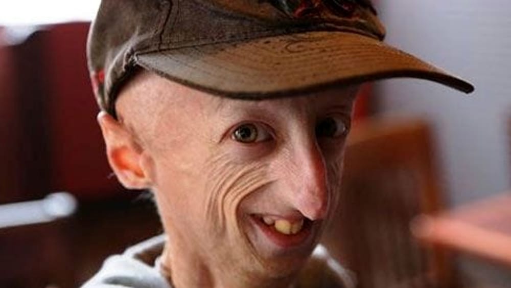 una bella lezione di&nbsp;vita